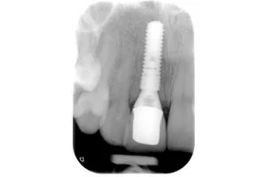 X Ray